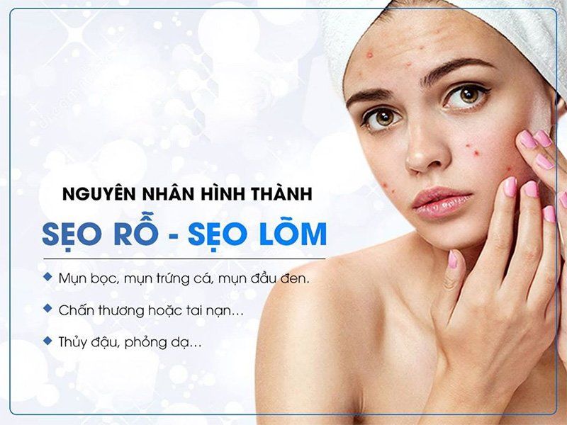 HIEU-DUNG-VE-SEO-CO-CHE-HINH-THANH-VA-GIAI-PHAP-PHUC-HOI-DA-TON-THUONG-HIEU-QUA_Cơ Chế Hình Thành Sẹo.jpg