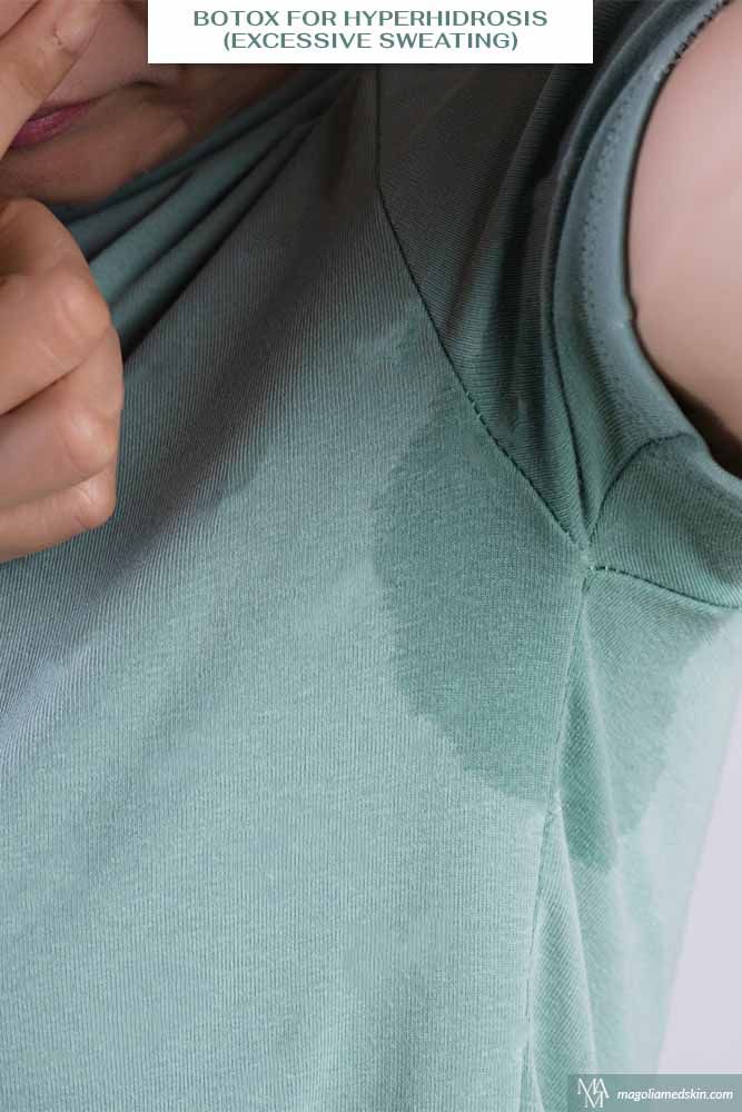 Hôi Nách Là Gì? Nguyên Nhân, Dấu Hiệu Và Cách Điều Trị Hiệu Quả