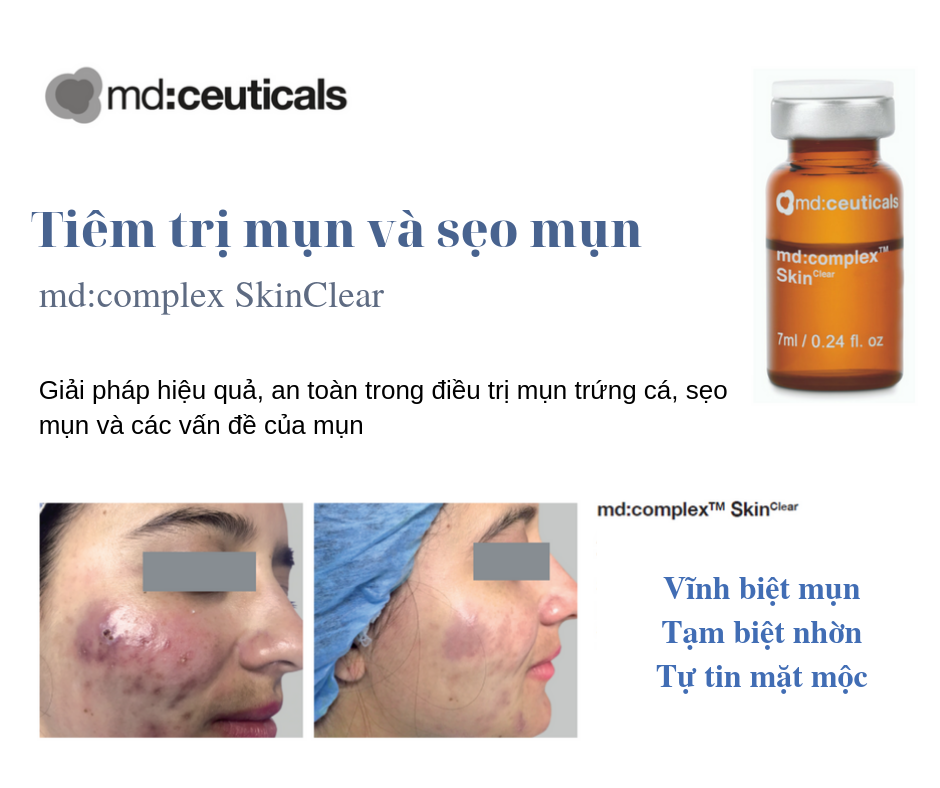 Phân Biệt Các Loại Mụn Phổ Biến: Hướng Dẫn Chẩn Đoán Chuẩn Y Khoa