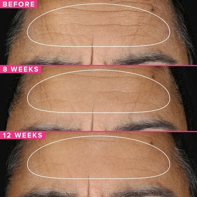 Retinol-la-gi-Phan-loai-tac-dung-va-cach-su-dung_Retinol 2-1.jpg