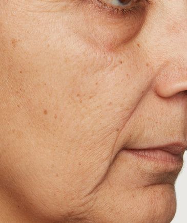 Sai Lầm Khiến Nếp Nhăn Xuất Hiện Sớm Hơn Bạn Tưởng
