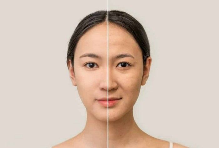 So-sanh-bakuchiol-va-retinol-nen-chon-loai-nao--3.jpg