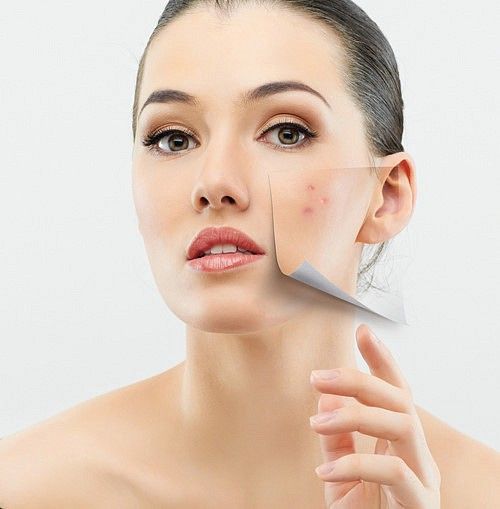 Top-10-cac-hoat-chat-tri-tham-mun-hieu-qua-hien-nay_Khám phá ngay các sản phẩm điều trị – dưỡng da – cải thiện thâm mụn tại Miền Thảo Mộc 1.jpg