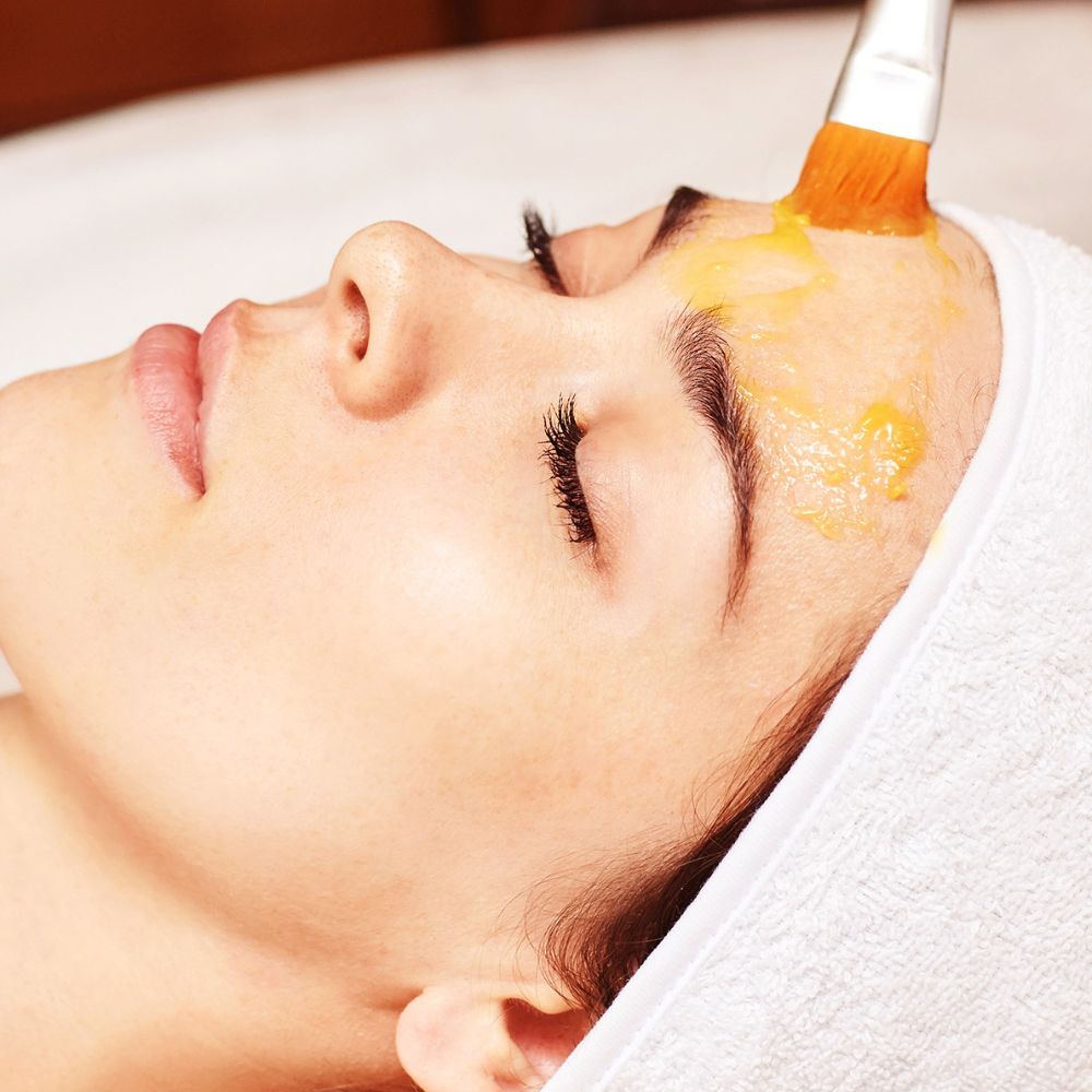 mien-thao-moc-spa-lieu-trinh-peel-da-tri-mun-viem-chuan-y-khoa