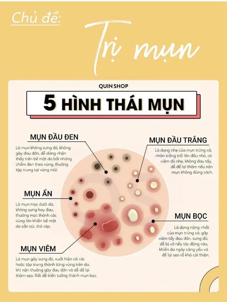 Khong-Lay-Nhan-Mun-Dung-Cach-Mun-Dau-Trang-Se-Nang-Hon-1.jpg