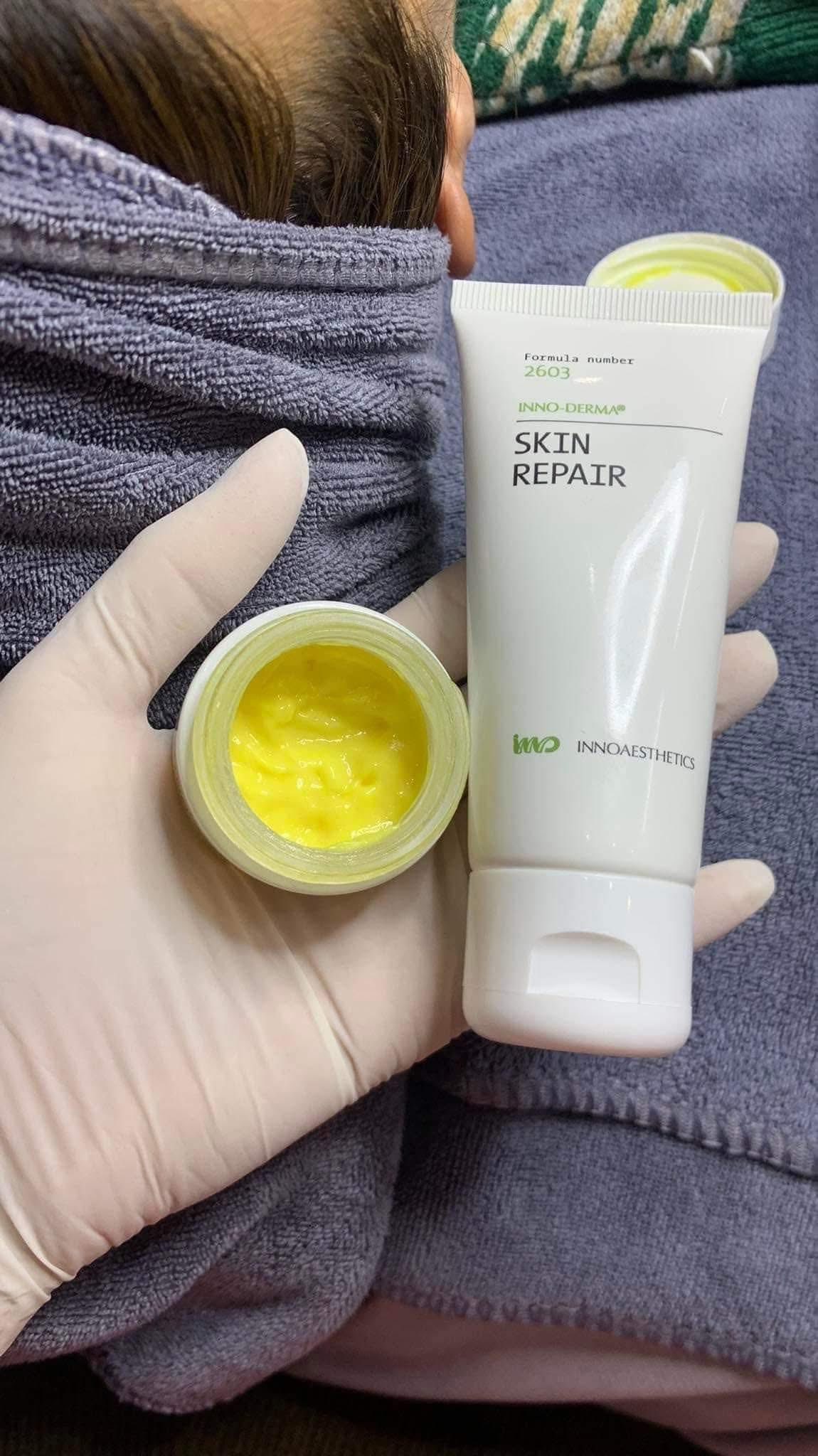 Review-Peel-Lightening-Innoaesthetics-Tri-mun-an-dau-den-amp-sang-da-1.jpg