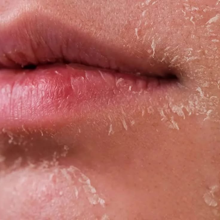 Tretinoin-Co-Dung-Hang-Ngay-Duoc-Khong--2.jpg