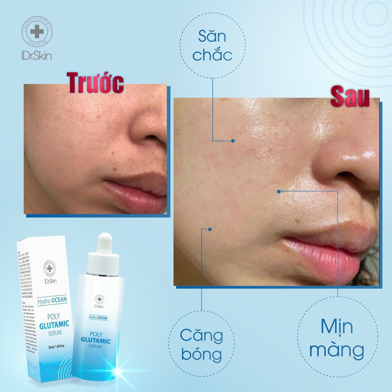 Serum cấp và khoá ẩm chuyên sâu Poly Glutamic Serum Idrskin