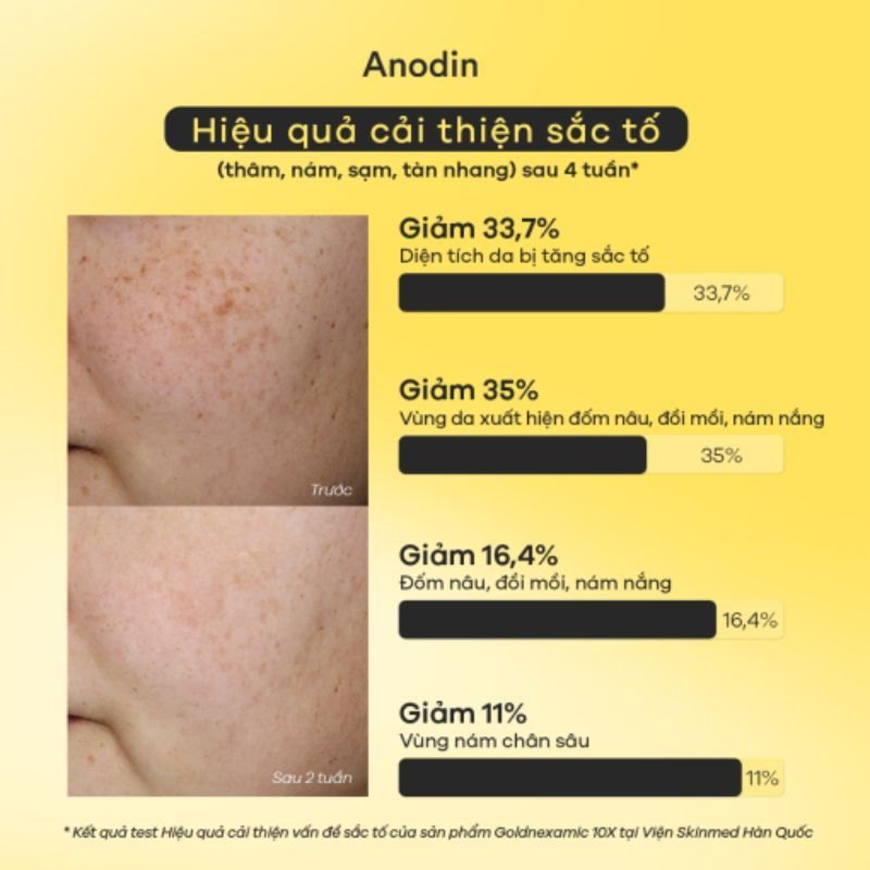 Serum trắng da mờ thâm nám đa tầng Anodin GOLDNEXAMIC 10X Serum 30ml