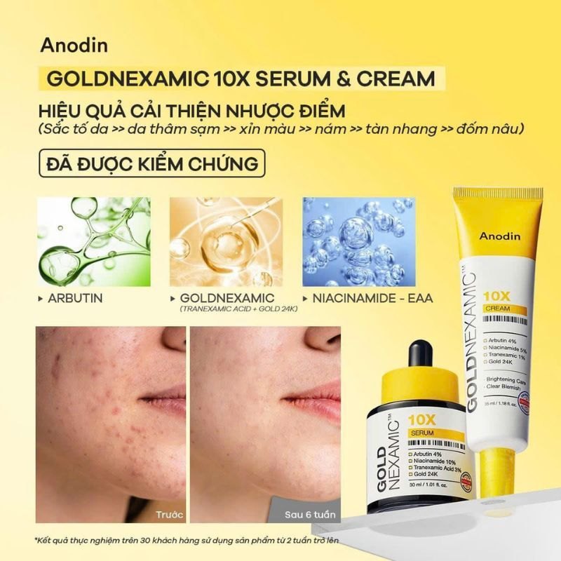 Serum trắng da mờ thâm nám đa tầng Anodin GOLDNEXAMIC 10X Serum 30ml