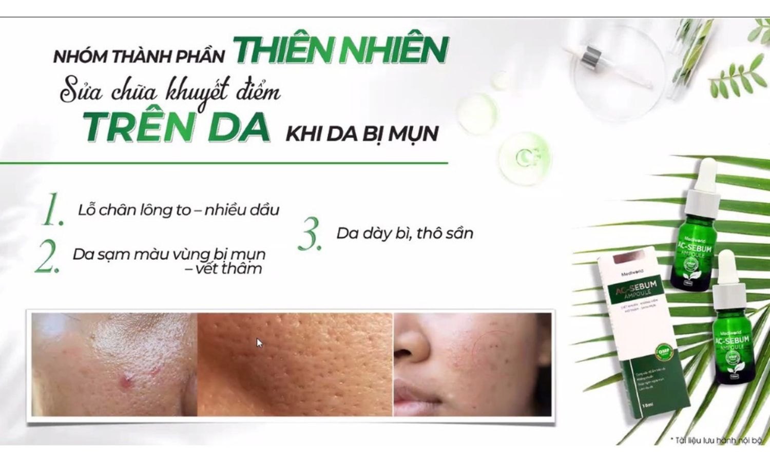 Serum hỗ trợ chăm sóc và ngăn ngừa mụn AC - Sebum Ampoule Mediworld