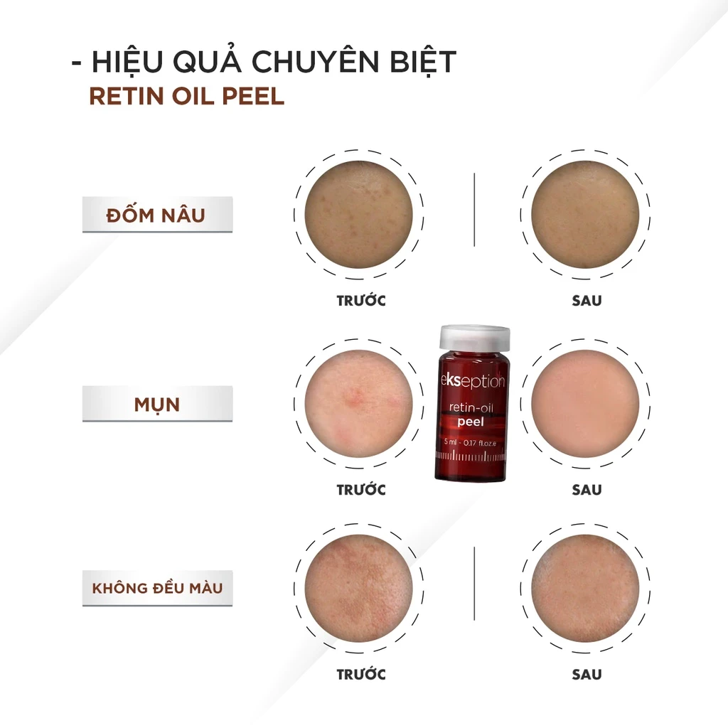 Tinh chất chống lão hoá Ekseption Retin Oil Peel