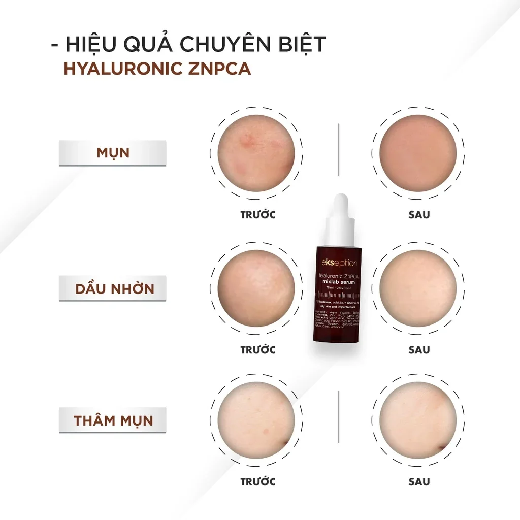 Tinh chất kiềm nhờn Ekseption Hyaluronic ZnPCA Mixlab Serum