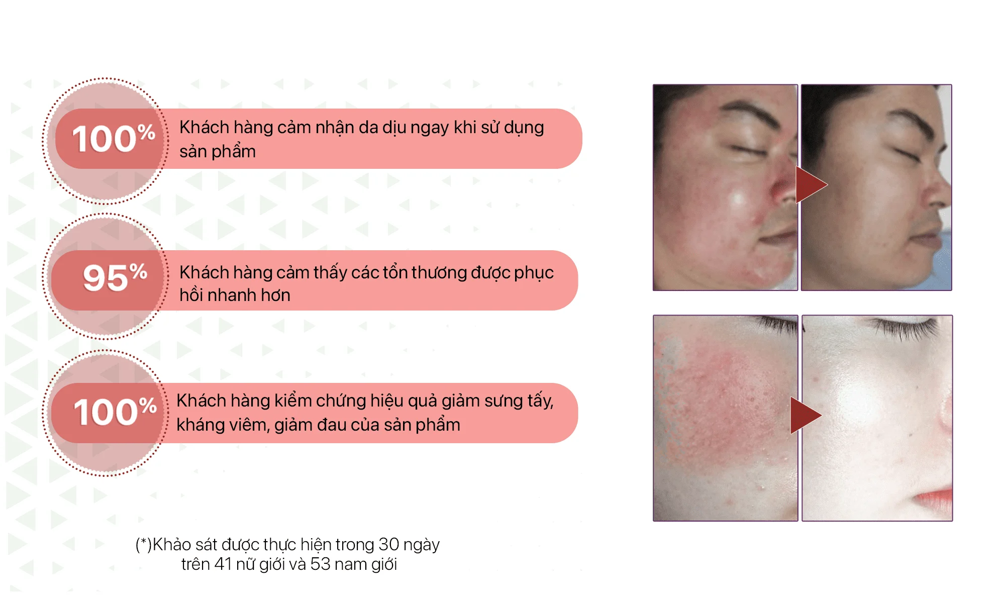 Serum hỗ trợ làm dịu da, phục hồi tổn thương da sau xâm lấn Geneworld G - Redness 30g