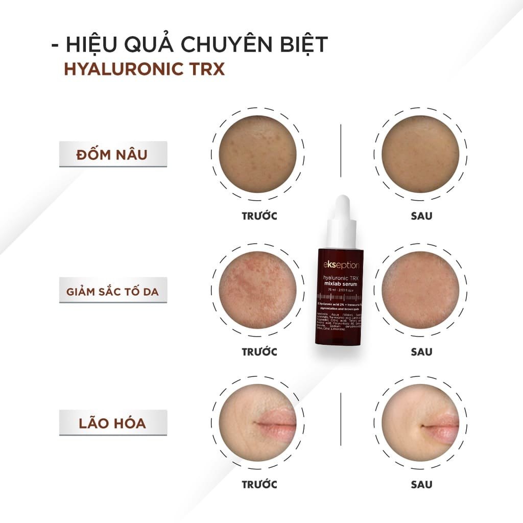 Tinh chất sáng da Ekseption Hyaluronic TRX Mixlab Serum