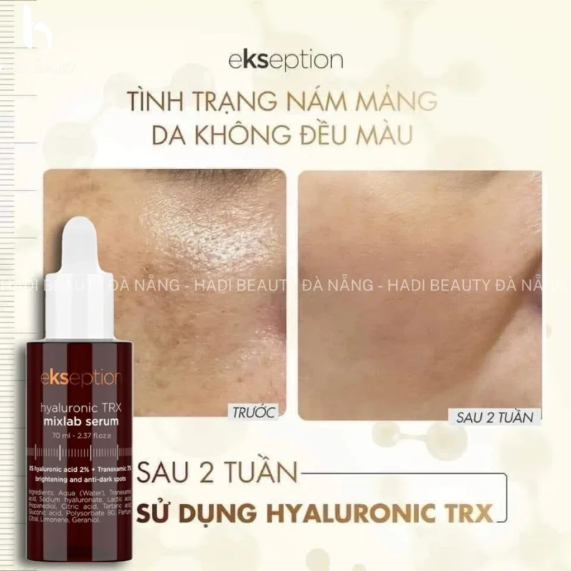 Tinh chất sáng da Ekseption Hyaluronic TRX Mixlab Serum