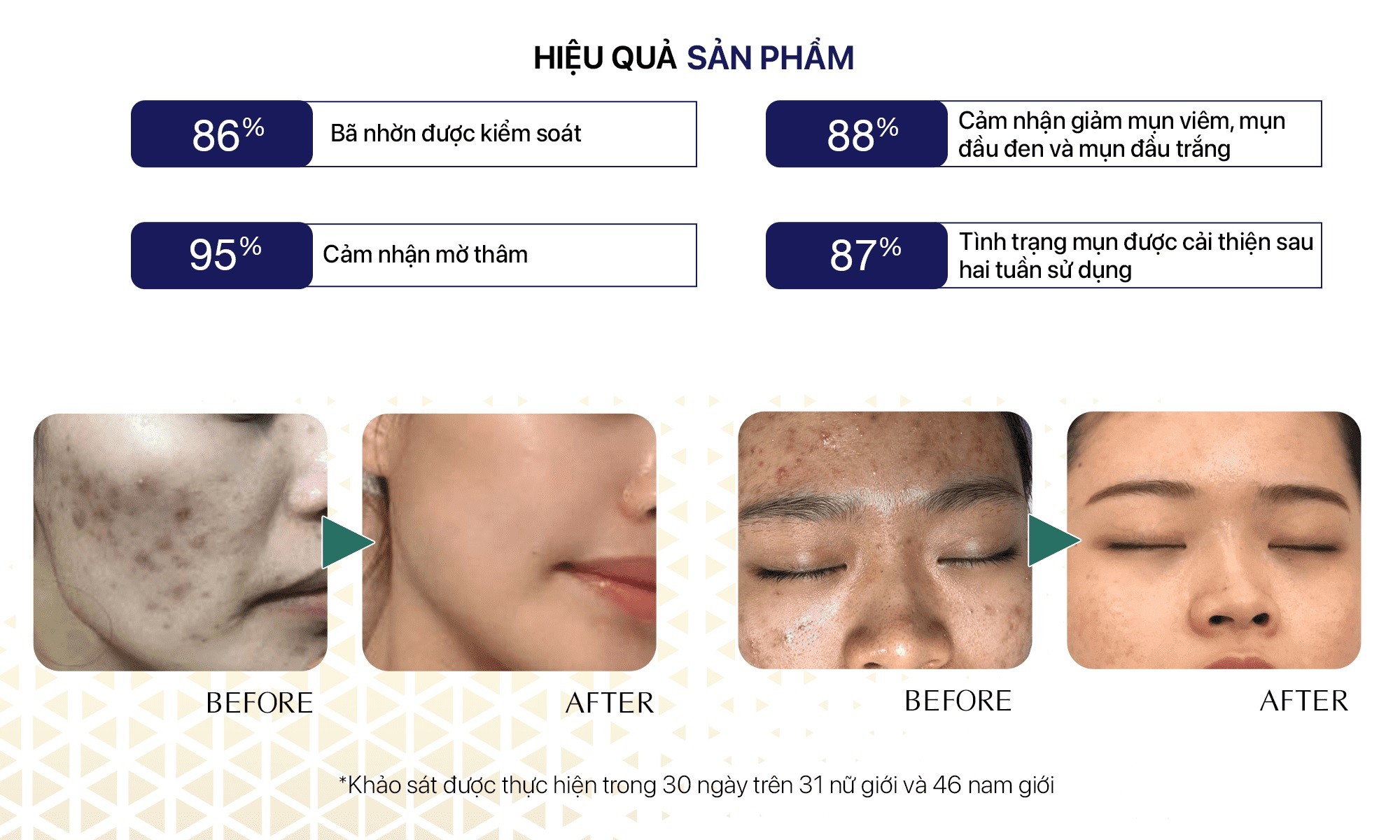 Gel lợi khuẩn loại bỏ mụn viêm Geneworld ACNEGEN MICROBIOME