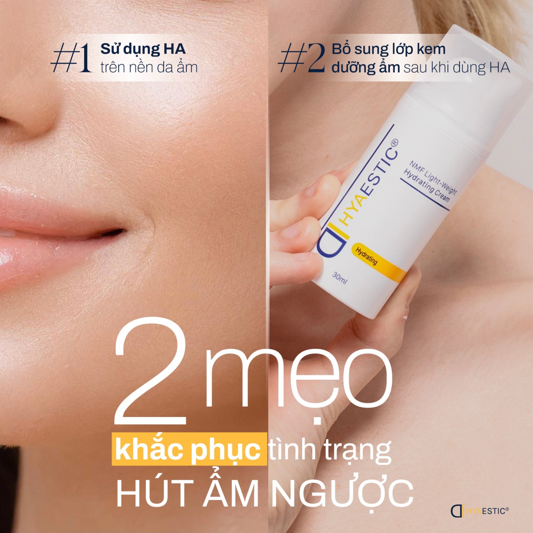 Kem Phục Hồi Da Hyaestic NMF Light-Weight Hydrating Cream 30ml