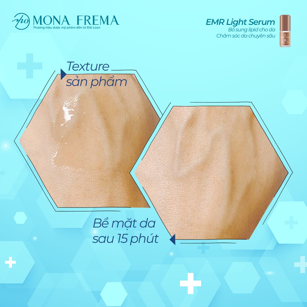 Serum Dưỡng Ẩm Mona Frema EMR Ceramide Repairing Light Serum 30ml