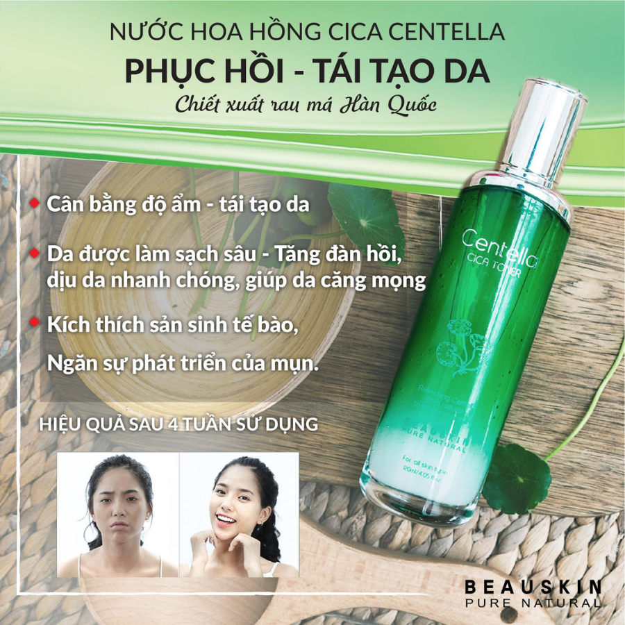 Nước hoa hồng chiết xuất rau má dưỡng ẩm trắng da BEAUSKIN Centella Cica Toner 120ml