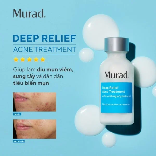 Sữa chấm mụn chuyên sâu Murad Deep Relief Acne Treatment 30ml