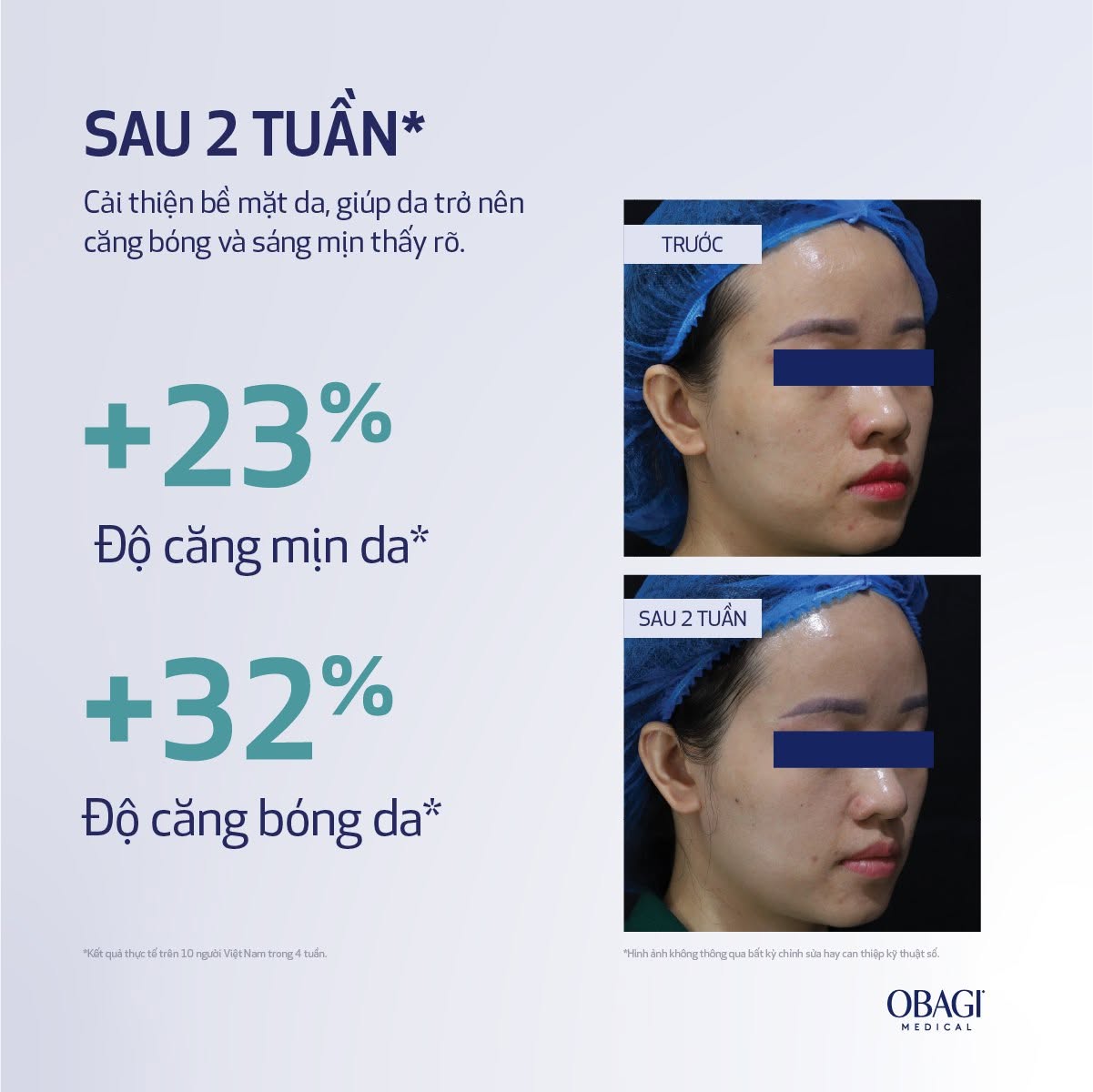 Kem Dưỡng Ban Đêm Obagi Medical Retinol + PHA Night Cream | Tái Tạo Da & Giảm Nếp Nhăn