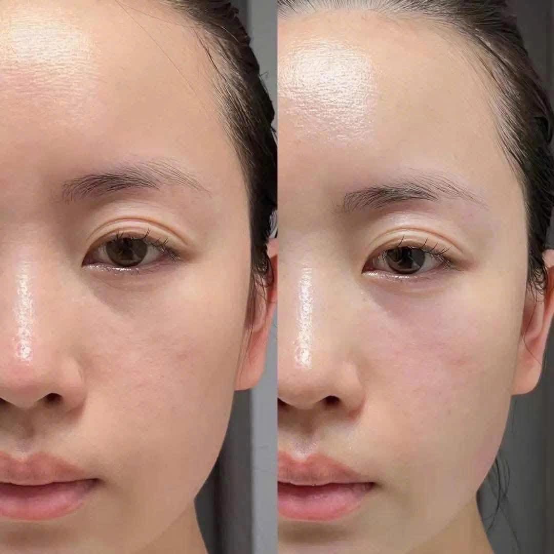 Kem dưỡng ẩm cấp ẩm suốt 8 giờ Obagi Hydrate