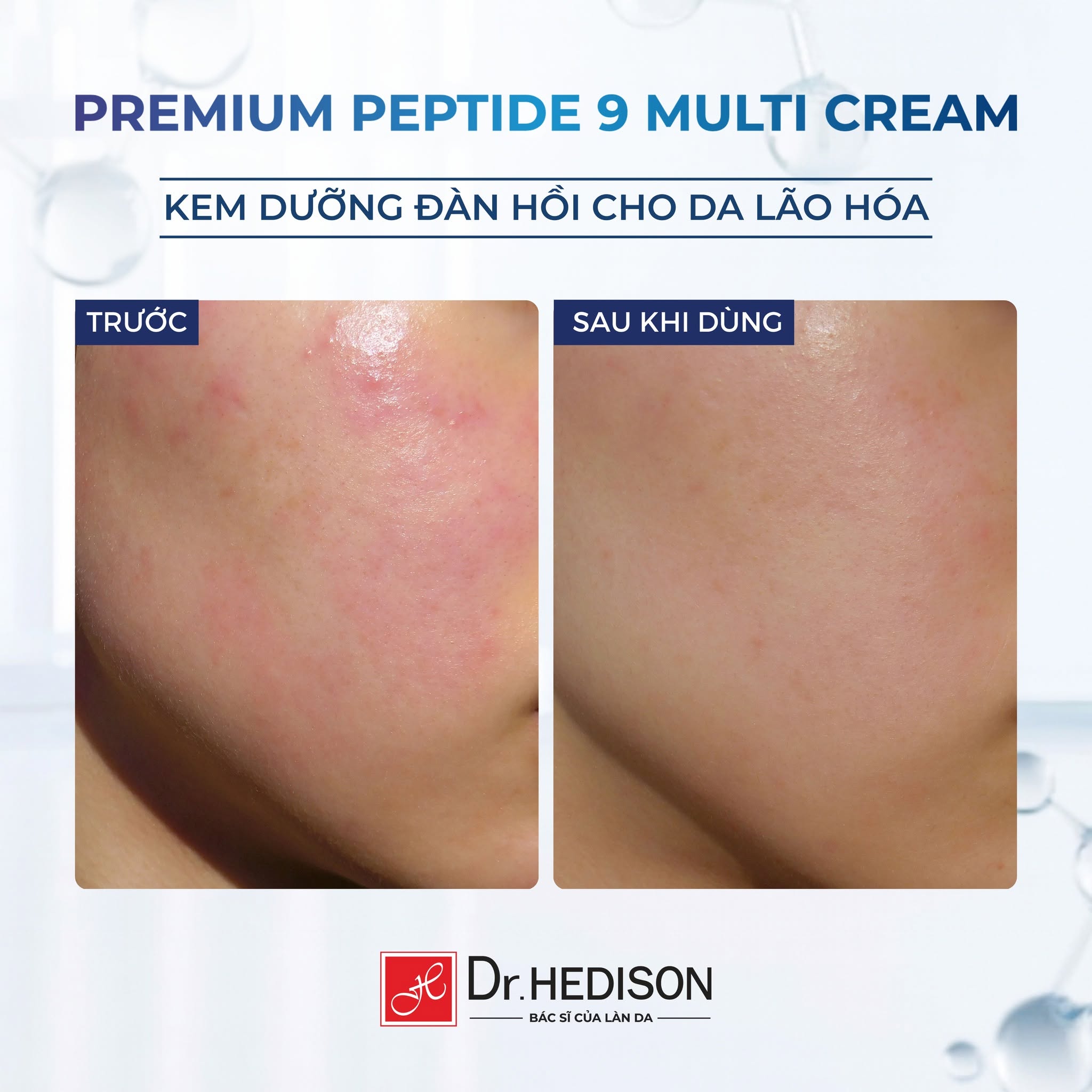 Kem dưỡng cao cấp giảm nhăn, trẻ hóa và tăng đàn hồi da Dr.HEDISON Premium Peptide 9+ 50ml