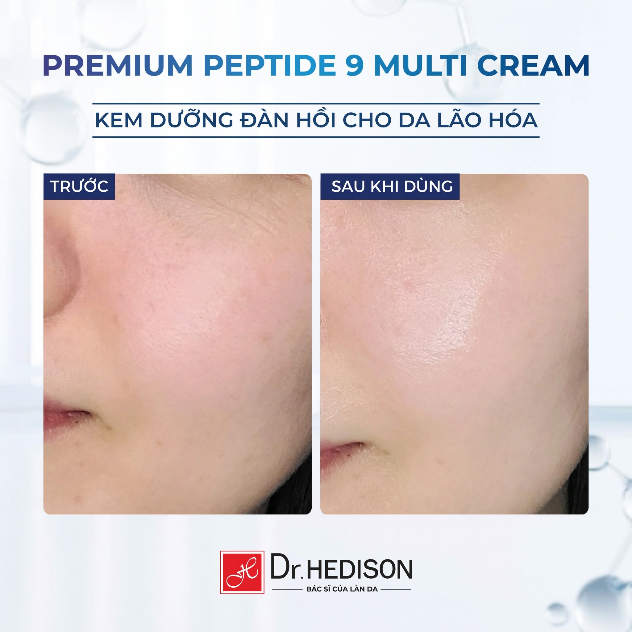 Kem dưỡng cao cấp giảm nhăn, trẻ hóa và tăng đàn hồi da Dr.HEDISON Premium Peptide 9+ 50ml