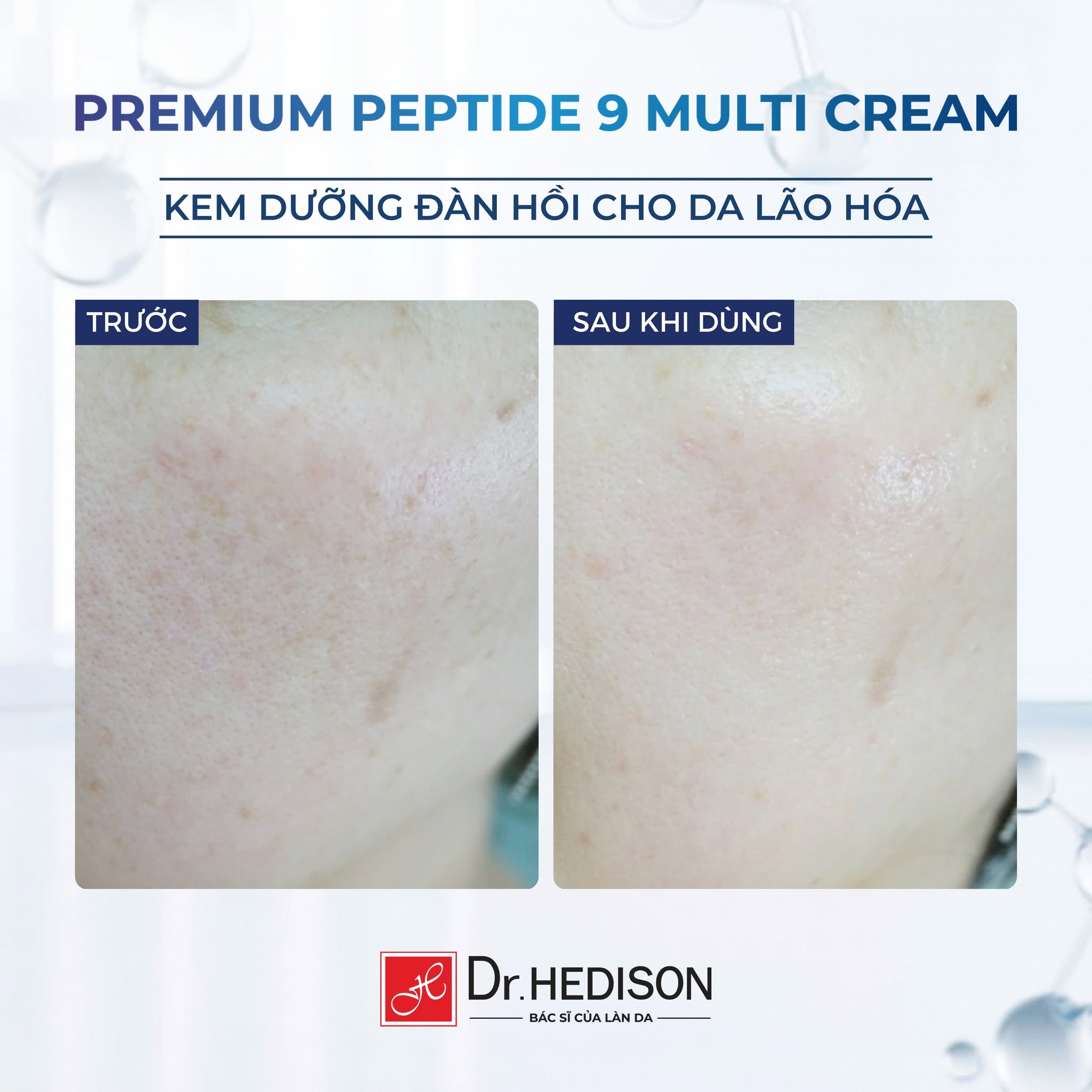 Kem dưỡng cao cấp giảm nhăn, trẻ hóa và tăng đàn hồi da Dr.HEDISON Premium Peptide 9+ 50ml