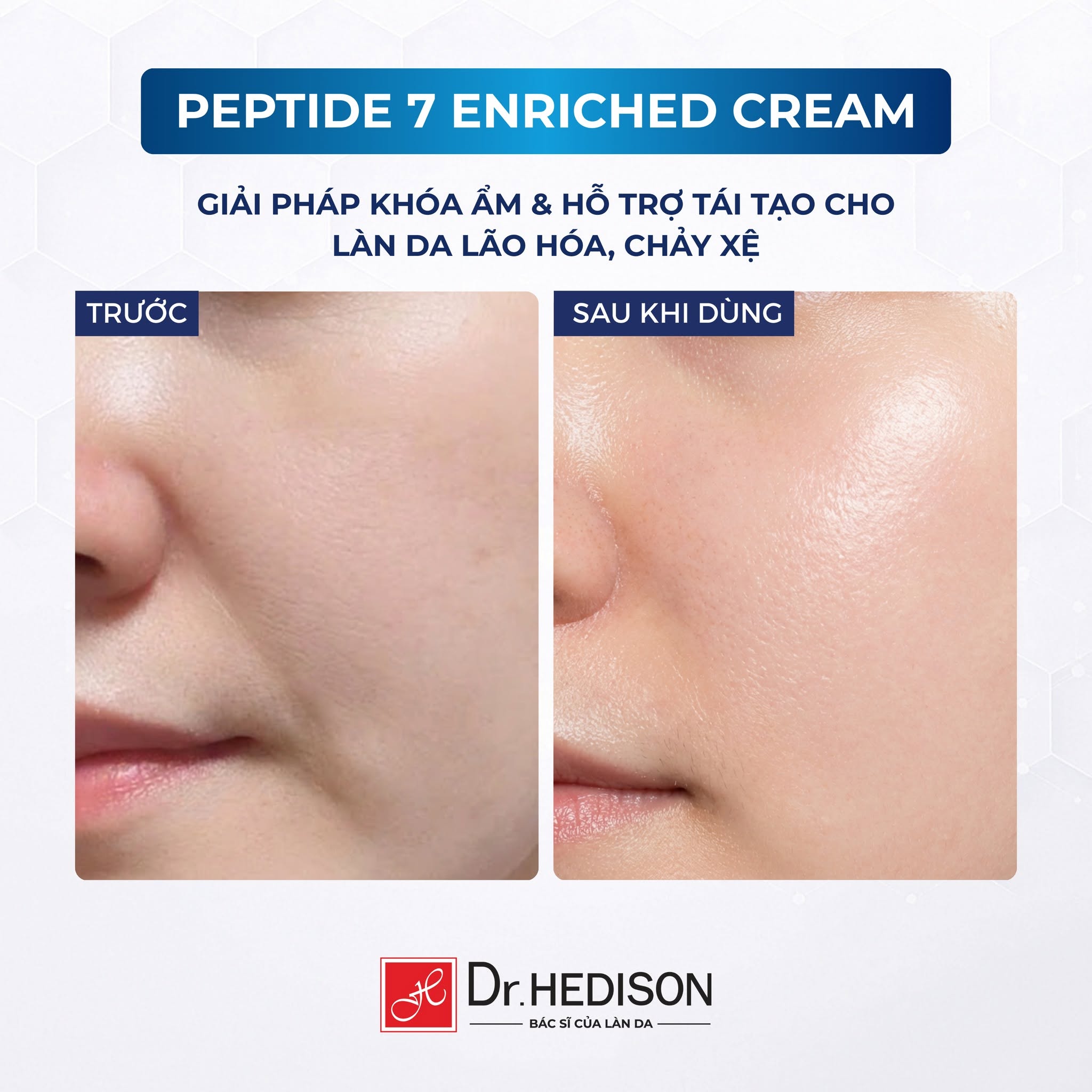Kem dưỡng giảm nếp nhăn, chăm sóc da lão hóa Dr.HEDISON Peptide 7 Enriched Cream