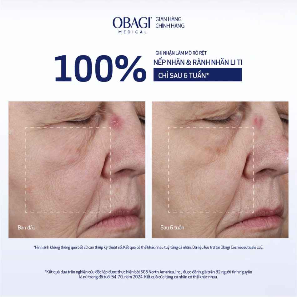 Kem dưỡng nâng cơ, làm mờ nếp nhăn Obagi ELASTIderm® Lift Up & Sculpt Facial Moisturizer