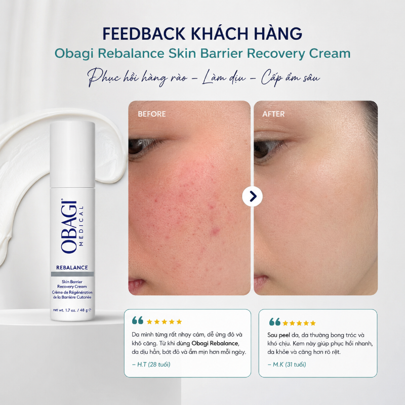 Kem dưỡng phục hồi Obagi Rebalance Skin Barrier Recovery Cream 48g