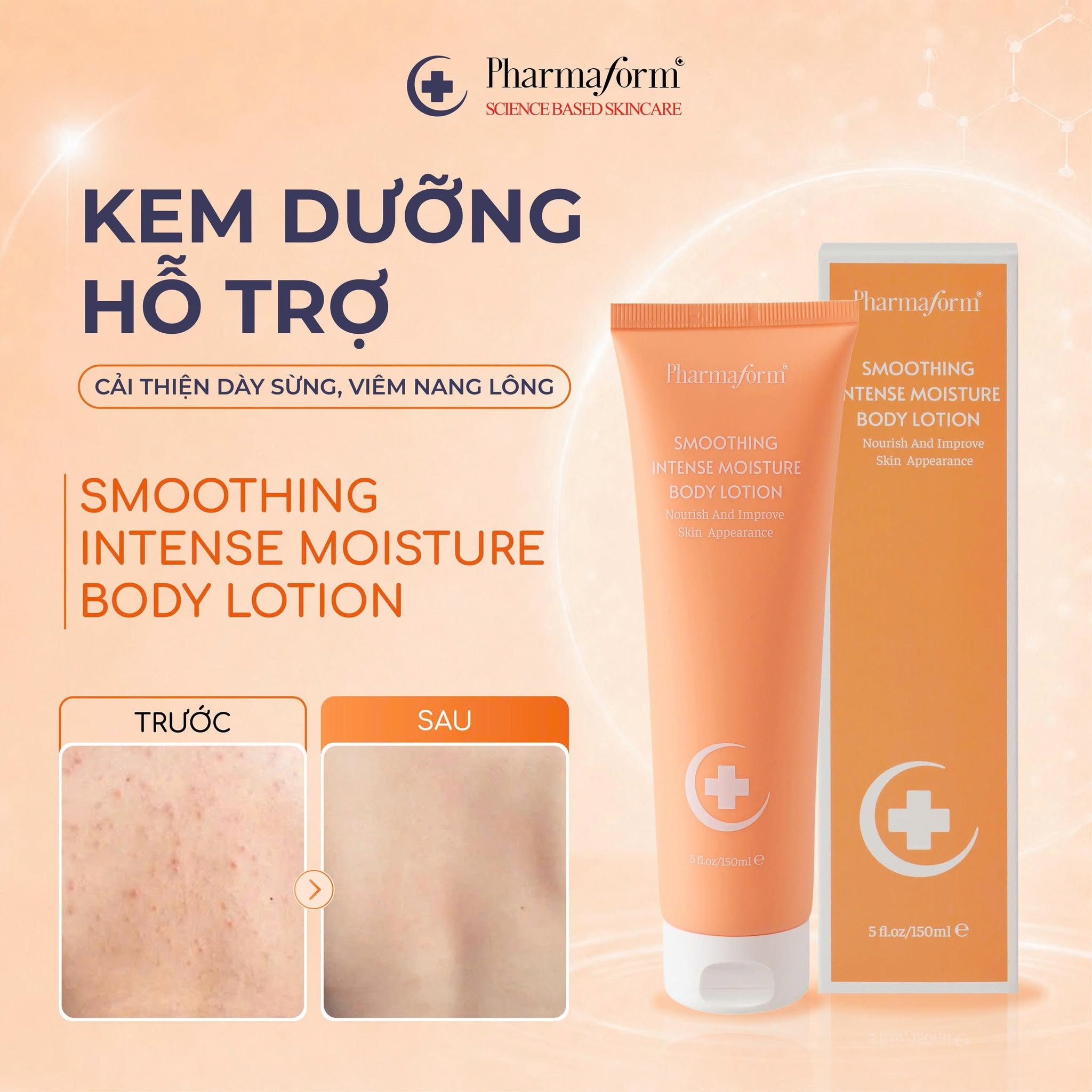 Kem dưỡng thể dưỡng ẩm giảm viêm nang lông mụn cơ thể Pharmaform Smoothing Intense Moisture Body Lotion 150ml