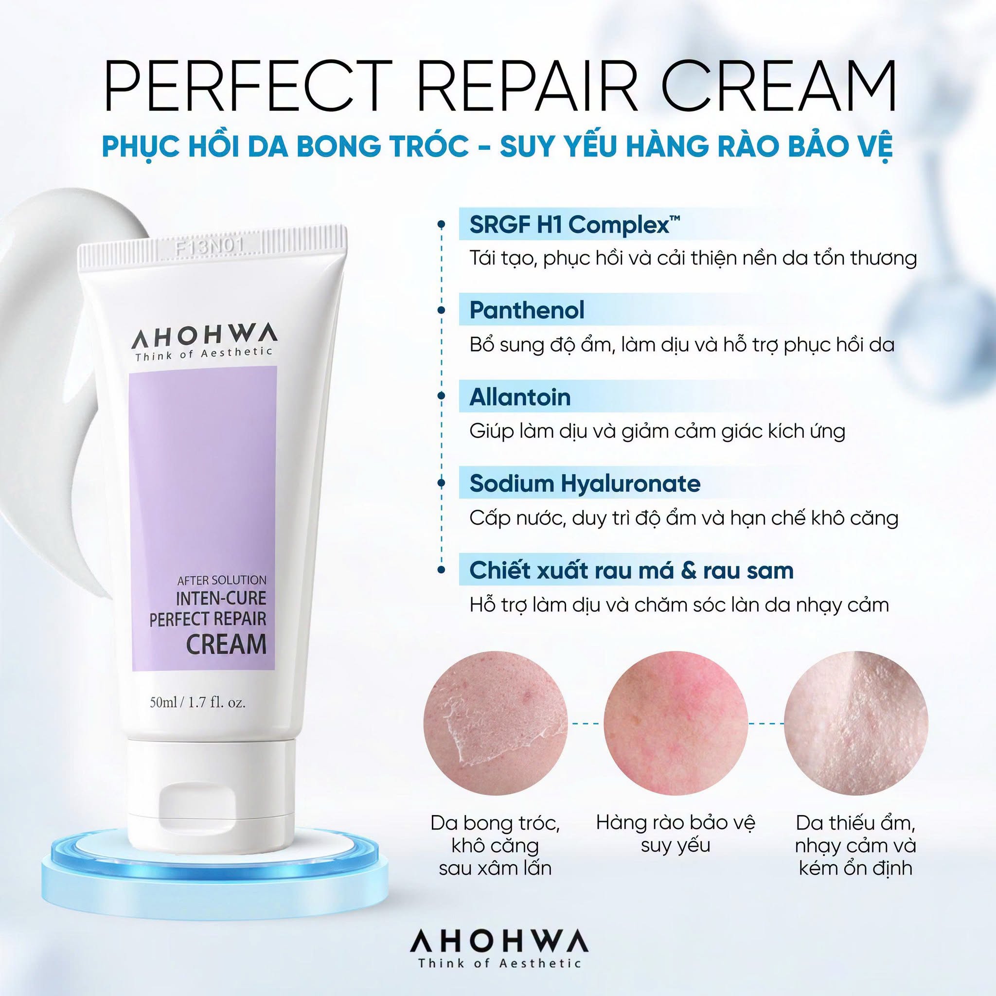 Kem tăng trưởng phục hồi da treatment Ahohwa After Solution Inten-Cure Perfect Repair Cream