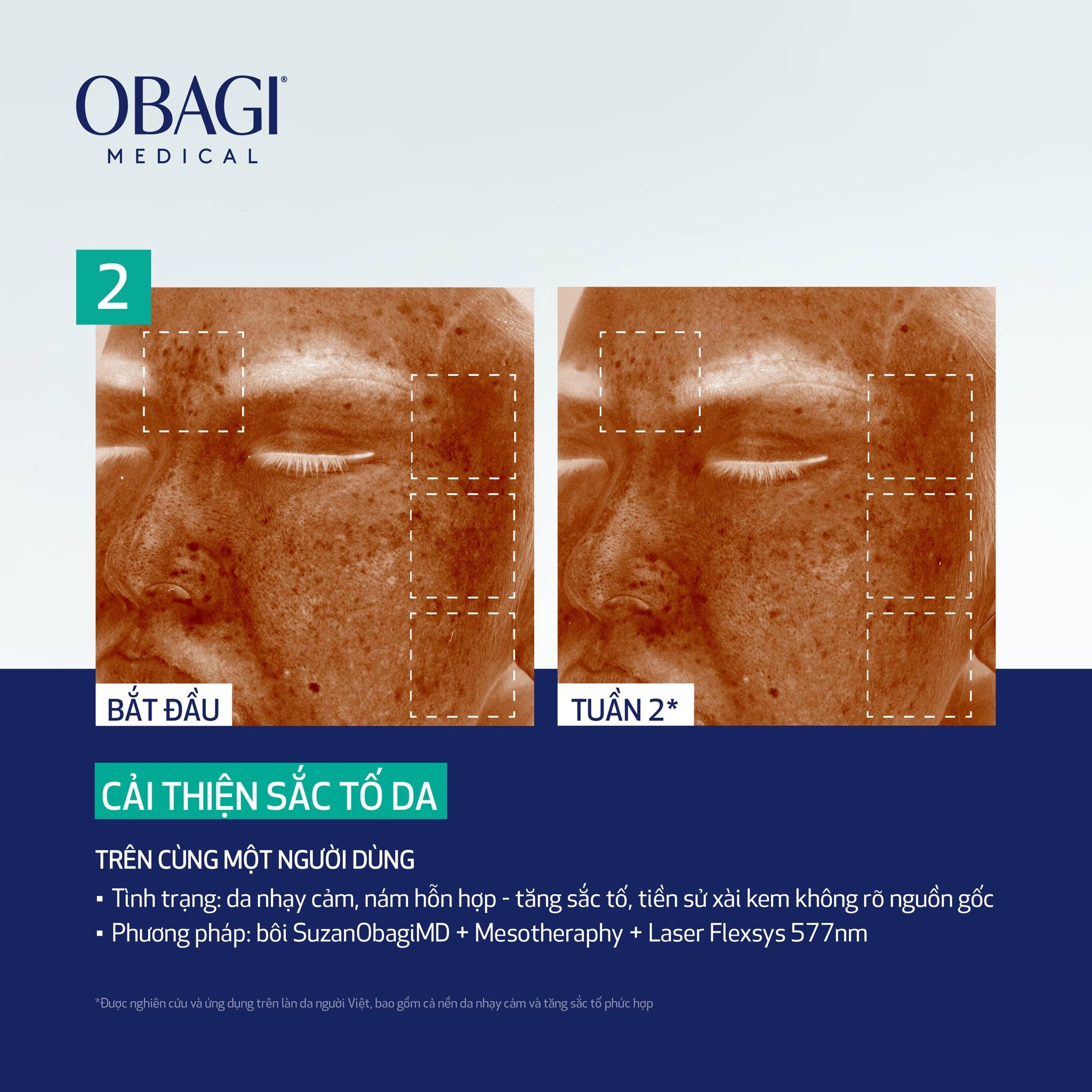 Lotion Dưỡng Sáng Giảm Thâm Nám Obagi SUZANOBAGIMD® Claribright Chính Hãng