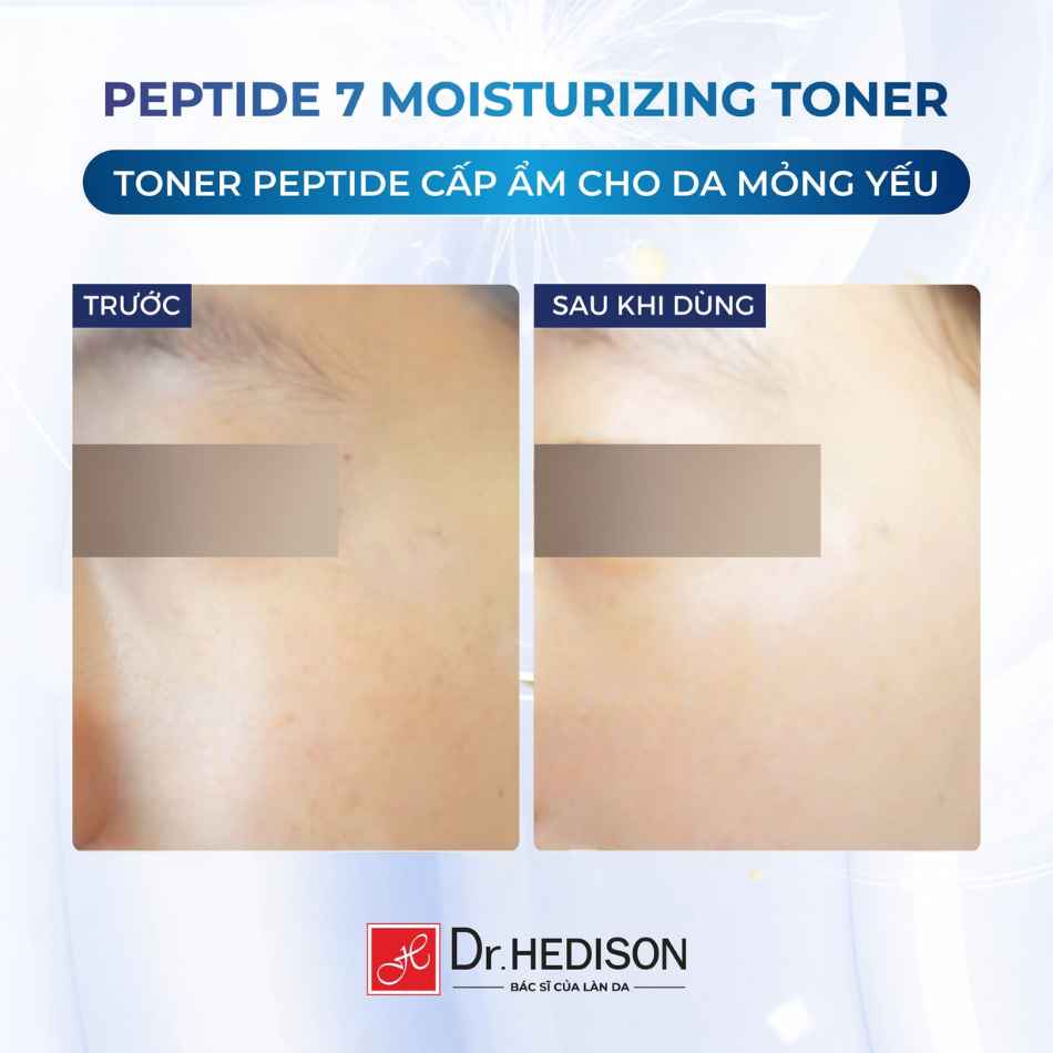 Nước hoa hồng cấp ẩm, hỗ trợ chăm sóc da lão hóa Dr.HEDISON Peptide 7 Moisturizing Toner