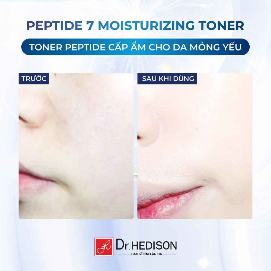 Nước hoa hồng cấp ẩm, hỗ trợ chăm sóc da lão hóa Dr.HEDISON Peptide 7 Moisturizing Toner