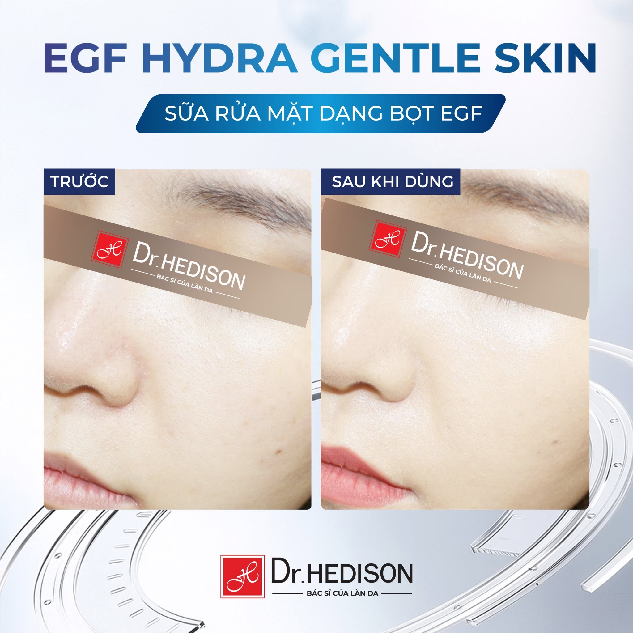 Sữa rửa mặt dạng bọt tái tạo,hỗ trợ phục hồi và bảo vệ hàng rào da EGF Limpid Foam Cleanser Dr. Hedison 180ml