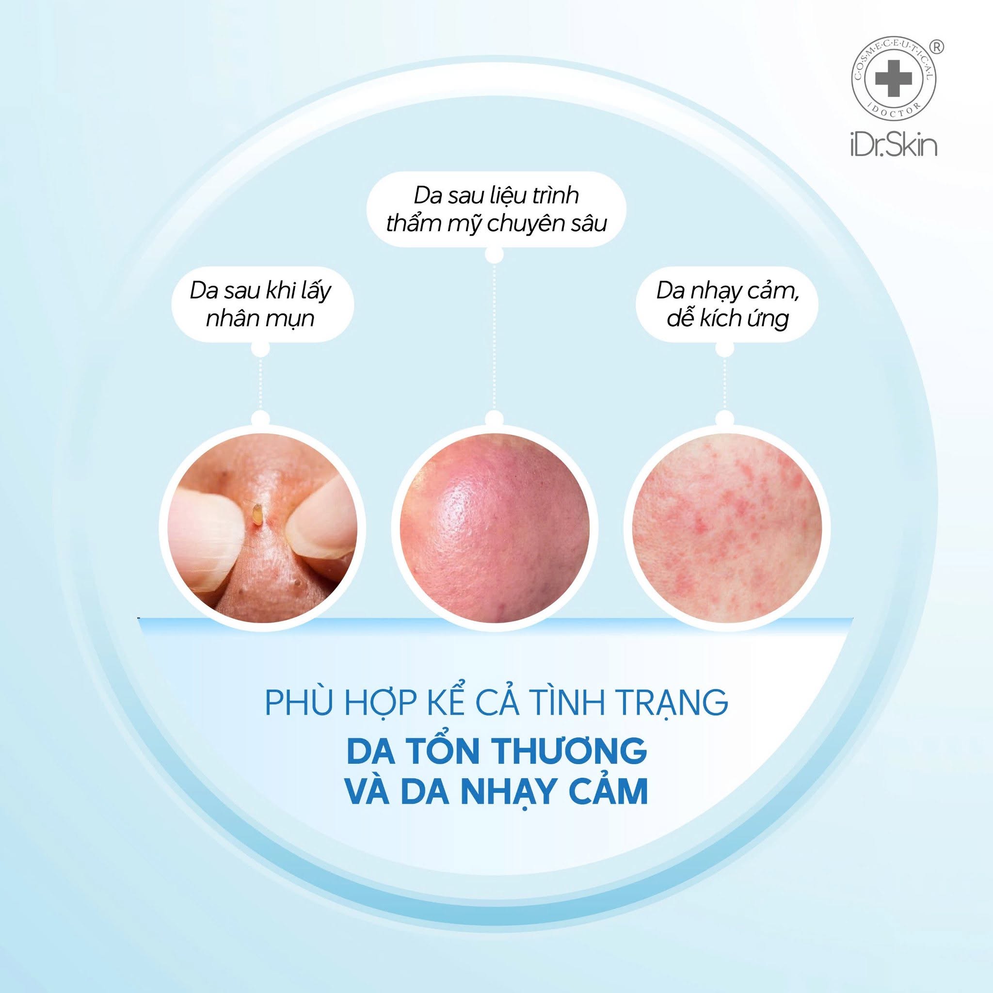 Sữa rửa mặt tự tạo bọt IDr. Skin O2 Natural Detox Bubble Cleansing Gel iDr.Skin