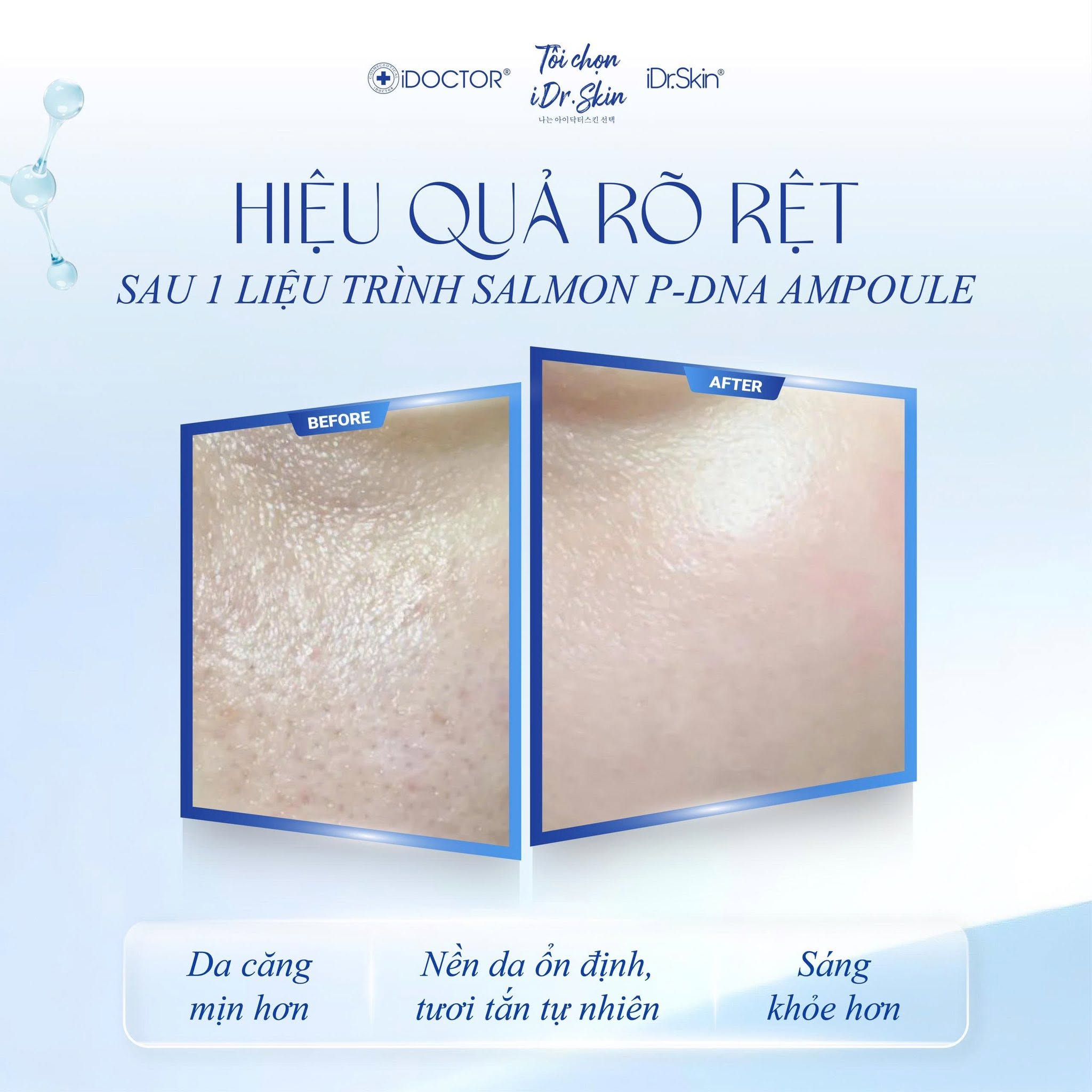 Tế bào gốc cho làn da trẻ hoá căng bóng iDr.Skin Salmon P-DNA Ampoule