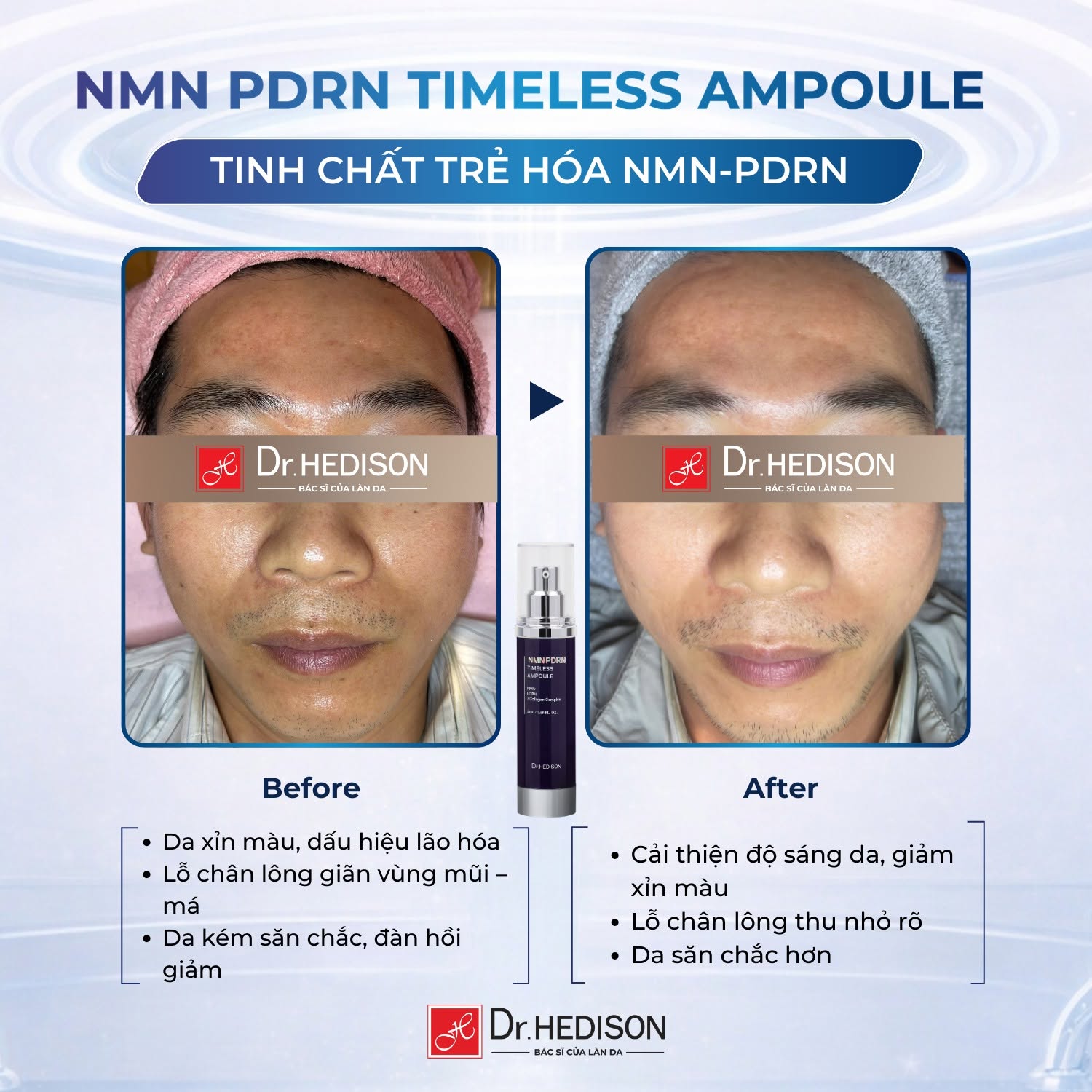 Tinh Chất Trẻ Hóa Dr.Hedison NMN PDRN Timeless Ampoule 50ml | Phục Hồi, Săn Chắc & Giảm Nếp Nhăn