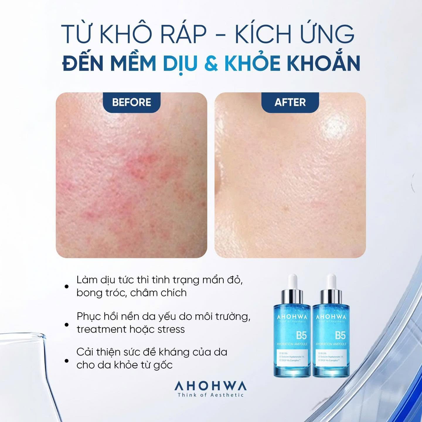 Tinh chất ampoule B5 cấp ẩm phục hồi da Ahohwa Hydration Ampoule B5