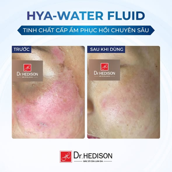 Tinh chất cấp ẩm phục hồi da Dr.HEDISON Hya-Water Fluid