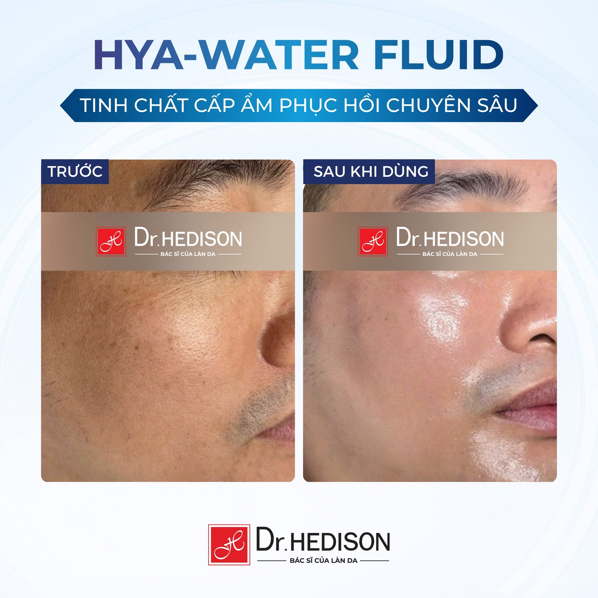 Tinh chất cấp ẩm phục hồi da Dr.HEDISON Hya-Water Fluid