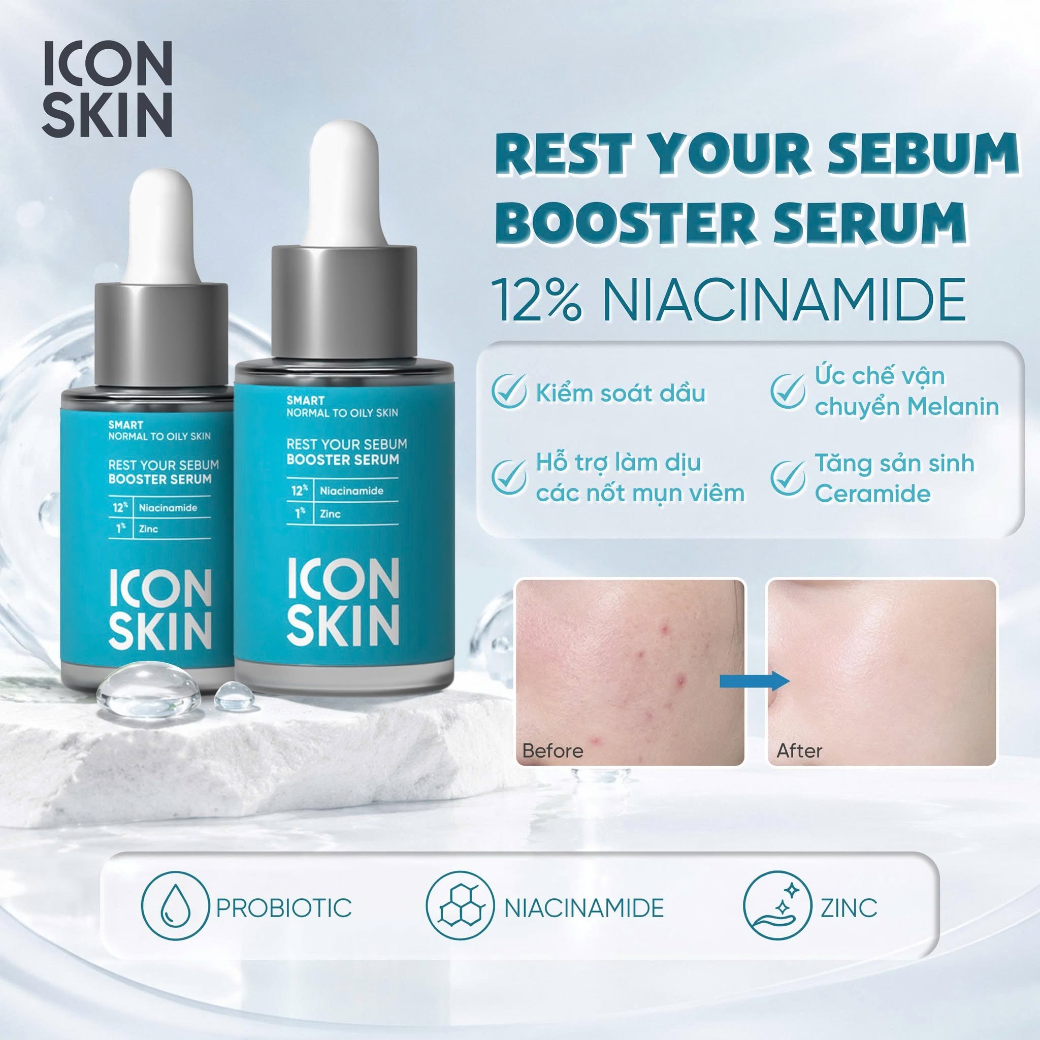 Tinh chất chuyên sâu cho da dầu và mụn Icon Skin Rest Your Sebum Booster Serum 12% Niacinamide