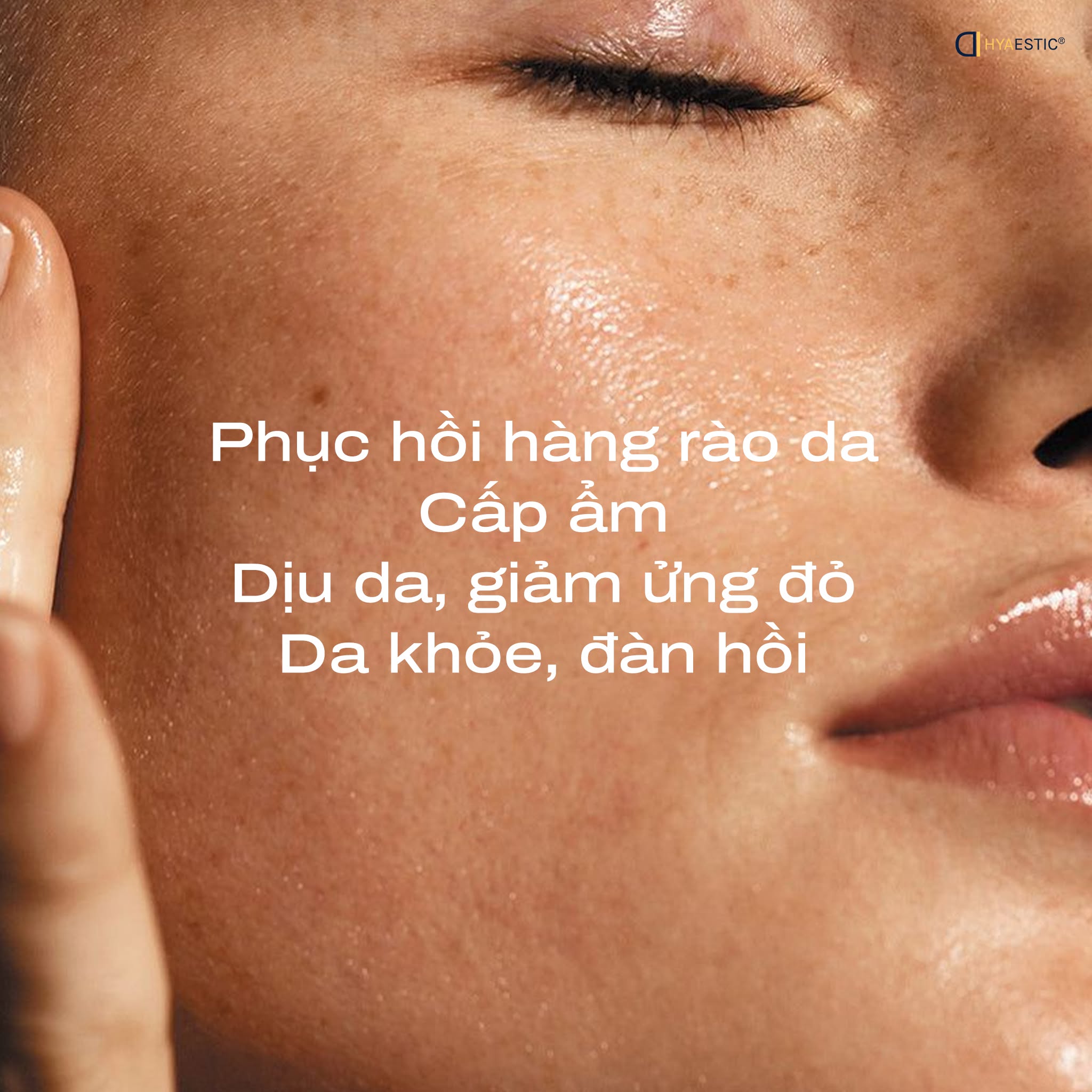 Tinh chất dưỡng ẩm phục hồi Hyaestic 3% Vitamin B5 Revital Serum