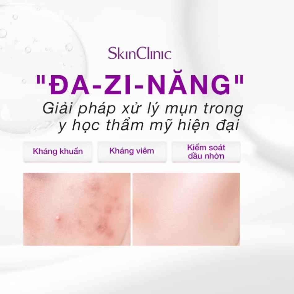 Tinh chất peel không bong điều tiết bã nhờn ức chế hình thành mụn SkinClinic Azalyc Peel Solution