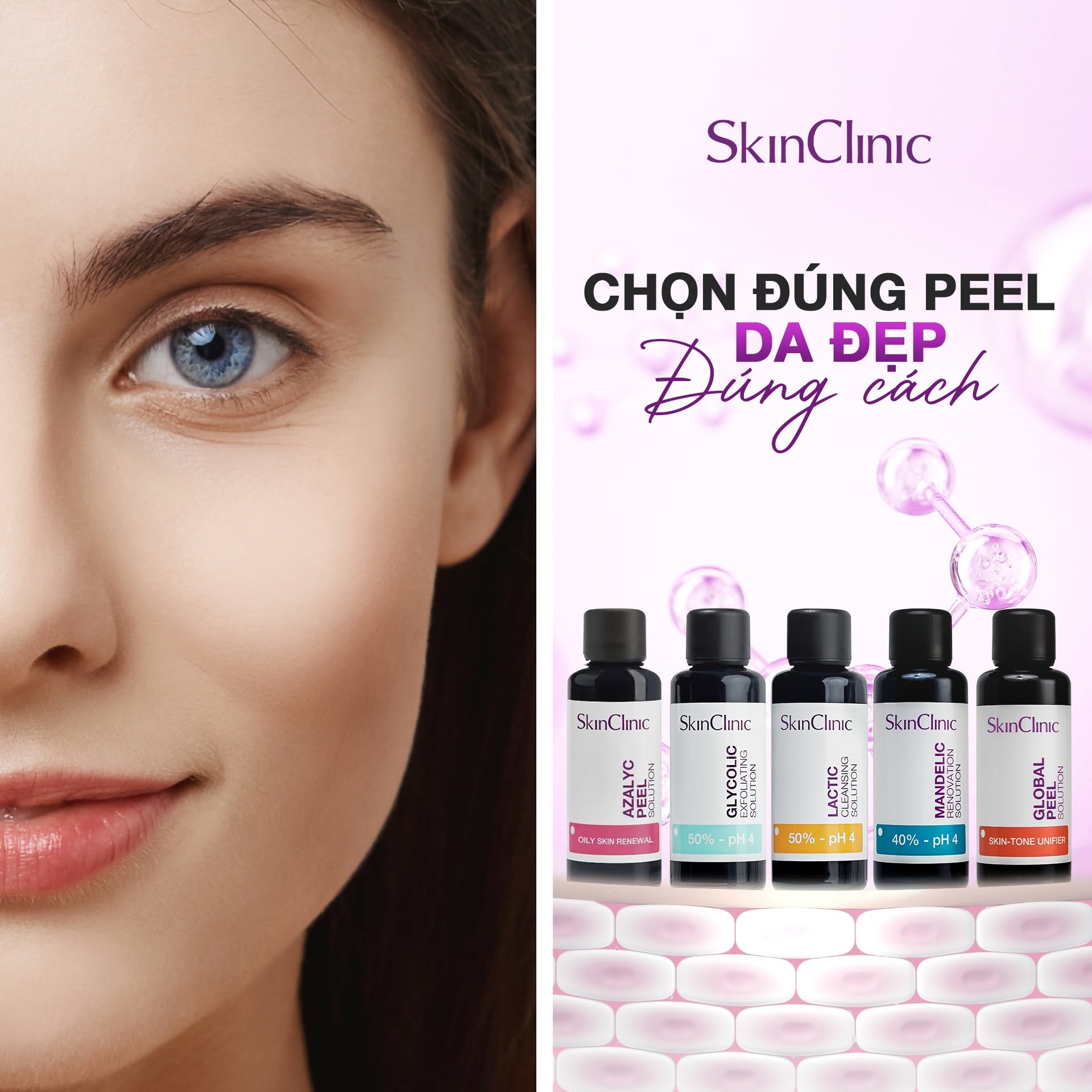 Tinh chất peel không bong làm sạch lỗ chân lông cải thiện kết cấu da SkinClinic Glycolic Exfoliating Solution