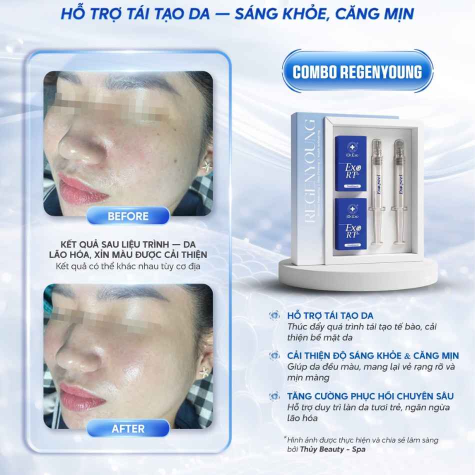 Tinh chất phục hồi tái tạo da iDr.Skin iDr.Exo RT Plus